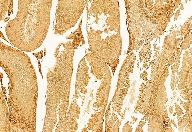 CXCL1 Antibody in Immunohistochemistry (Paraffin) (IHC (P))