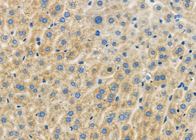 GTPBP1 Antibody in Immunohistochemistry (Paraffin) (IHC (P))