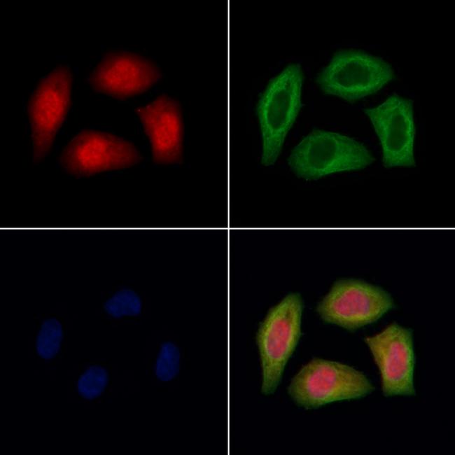 TNRC6A Antibody in Immunocytochemistry (ICC/IF)