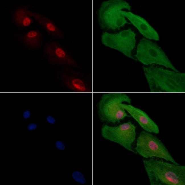 HAND2 Antibody in Immunocytochemistry (ICC/IF)