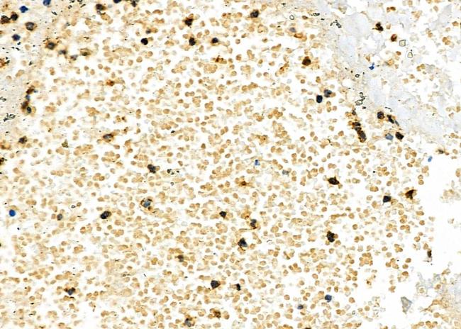 TIM-3 Antibody in Immunohistochemistry (Paraffin) (IHC (P))