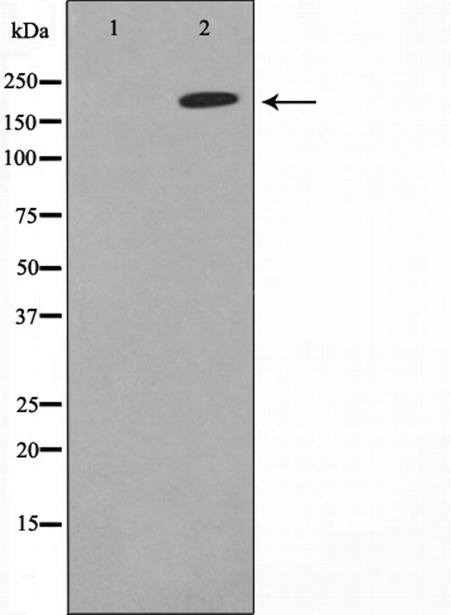 ErbB2 (HER-2) Antibody in Western Blot (WB)