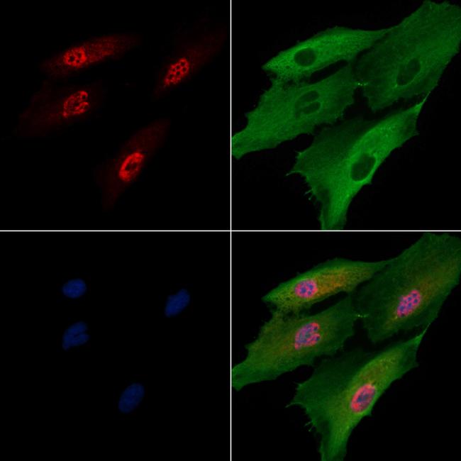 HLTF Antibody in Immunocytochemistry (ICC/IF)