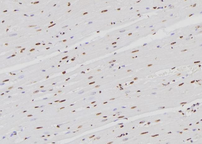 hnRNP K Antibody in Immunohistochemistry (Paraffin) (IHC (P))