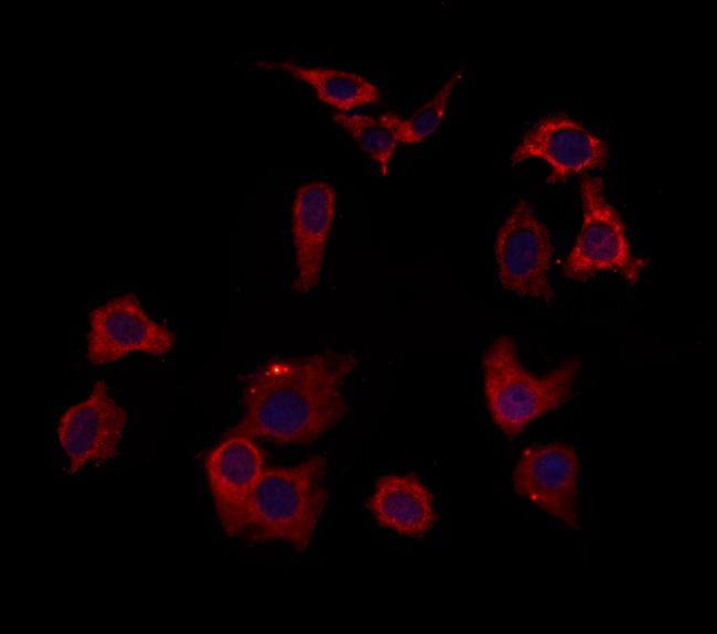 HOMER1 Antibody in Immunocytochemistry (ICC/IF)