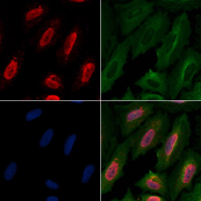 HP1 gamma Antibody in Immunocytochemistry (ICC/IF)