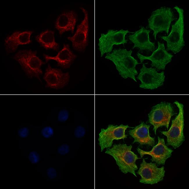 HSD17B1 Antibody in Immunocytochemistry (ICC/IF)