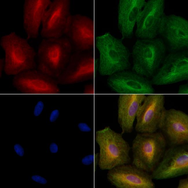 Ihh Antibody in Immunocytochemistry (ICC/IF)