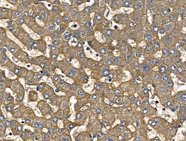 IL-12 p70 Antibody in Immunohistochemistry (Paraffin) (IHC (P))