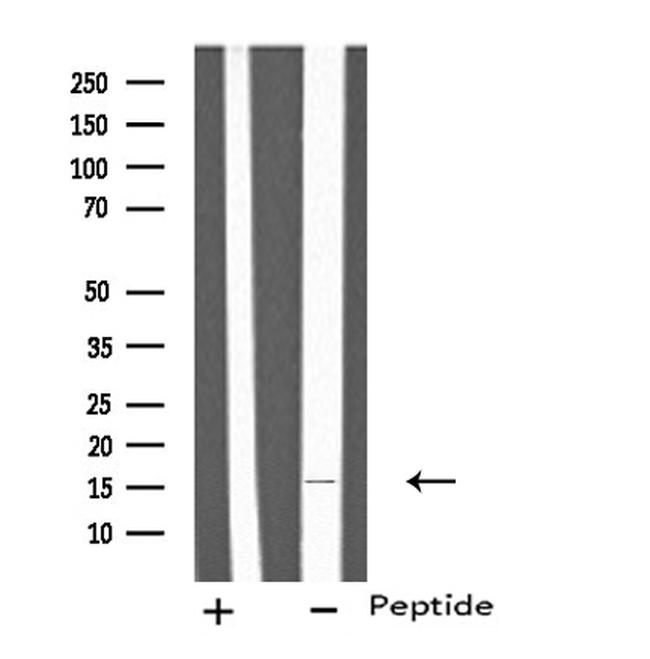 IL-4 Antibody in Western Blot (WB)