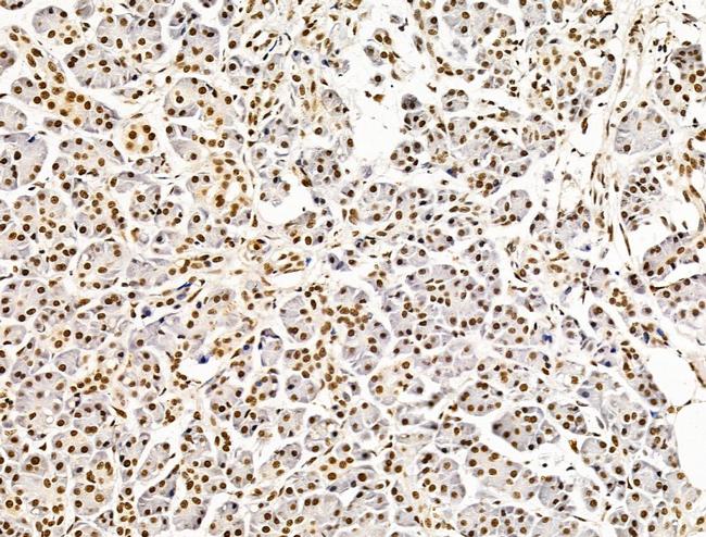 ILF1 Antibody in Immunohistochemistry (Paraffin) (IHC (P))