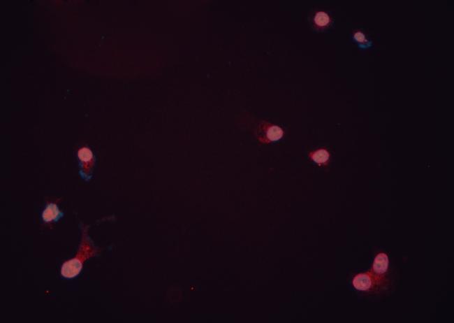 ILK Antibody in Immunocytochemistry (ICC/IF)