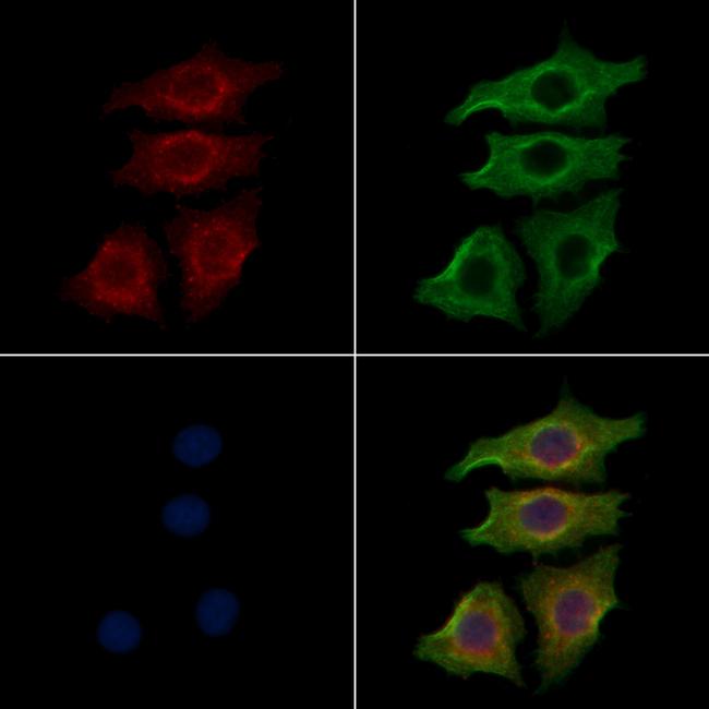 INSR Antibody in Immunocytochemistry (ICC/IF)