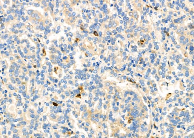 CD18 Antibody in Immunohistochemistry (Paraffin) (IHC (P))