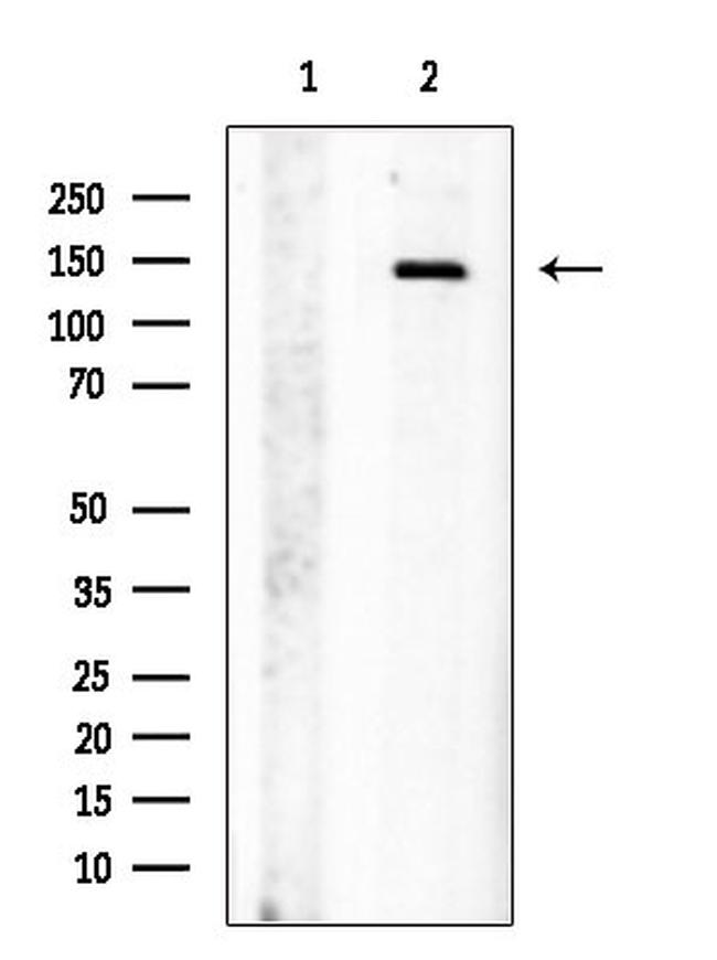 Jagged1 Antibody in Western Blot (WB)