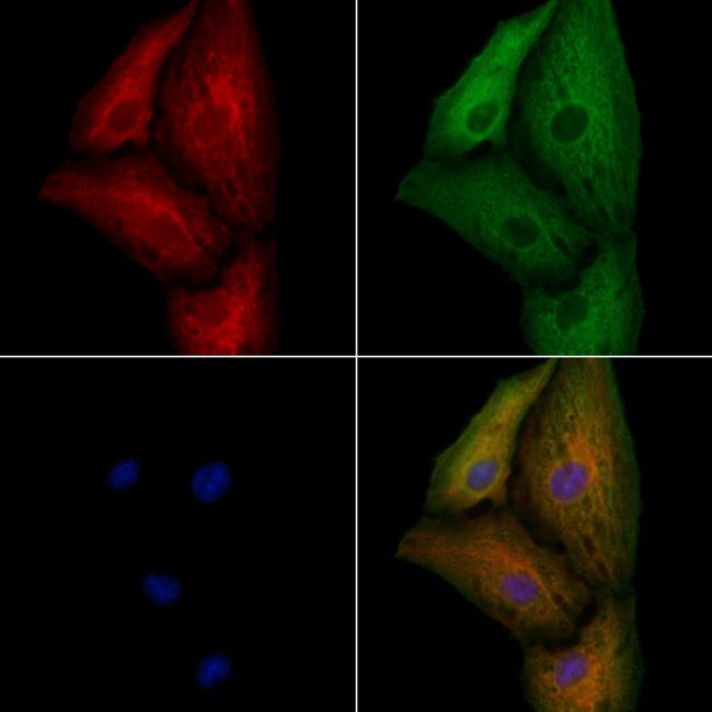 KCNK9 Antibody in Immunocytochemistry (ICC/IF)