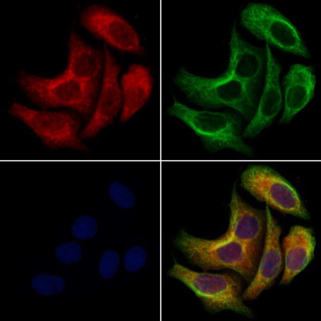 KCNN2 Antibody in Immunocytochemistry (ICC/IF)