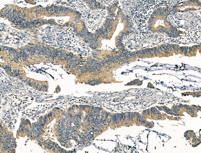 KCNN3 Antibody in Immunohistochemistry (Paraffin) (IHC (P))