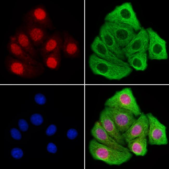 JMJD2B Antibody in Immunocytochemistry (ICC/IF)