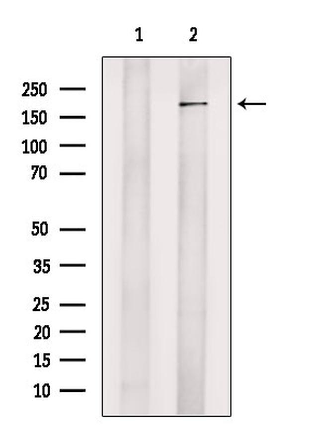 JMJD2C Antibody in Western Blot (WB)