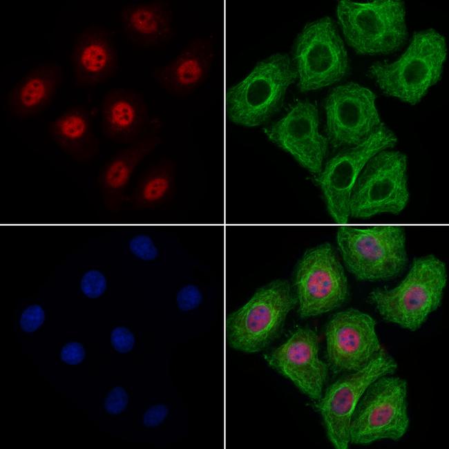 KIF17 Antibody in Immunocytochemistry (ICC/IF)