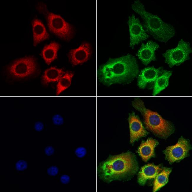 Varicella zoster Virus (strain Dumas) Antibody in Immunocytochemistry (ICC/IF)