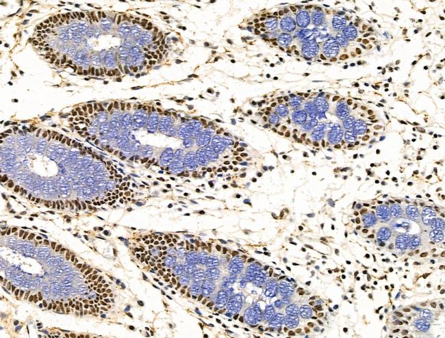 KLF2 Antibody in Immunohistochemistry (Paraffin) (IHC (P))