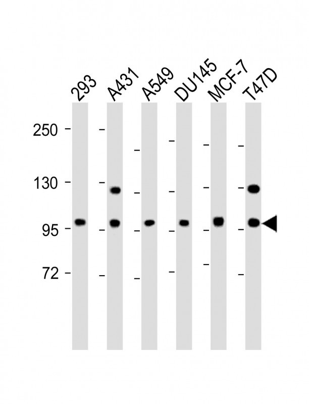 E-cadherin Antibody in Western Blot (WB)