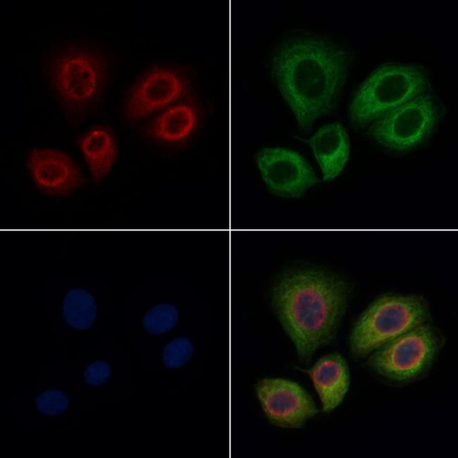 Kallikrein 1 Antibody in Immunocytochemistry (ICC/IF)