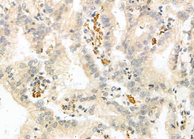 NKG2A Antibody in Immunohistochemistry (Paraffin) (IHC (P))