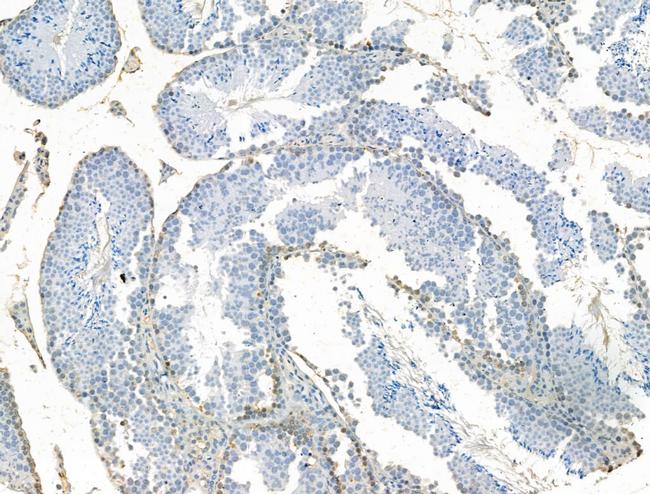 SETDB1 Antibody in Immunohistochemistry (Paraffin) (IHC (P))