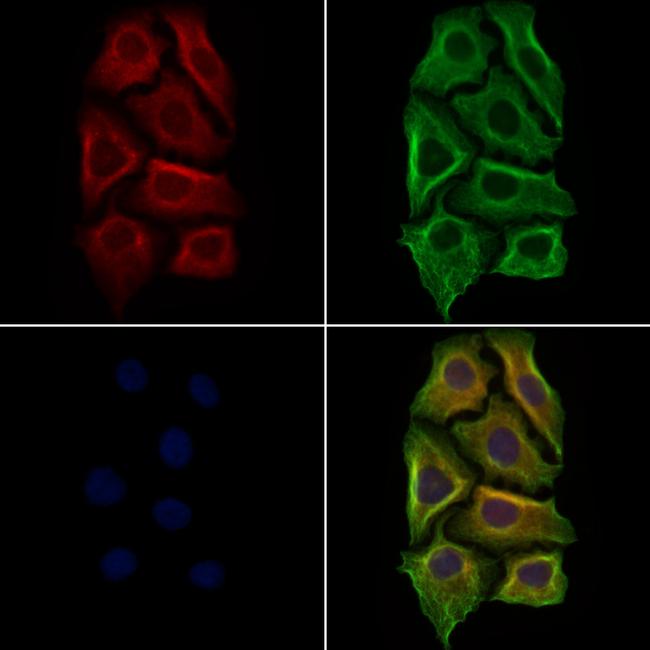 Laminin Antibody in Immunocytochemistry (ICC/IF)