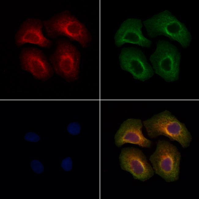 LAMTOR1 Antibody in Immunocytochemistry (ICC/IF)