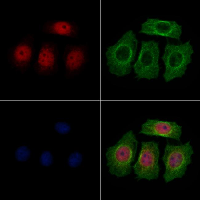 LAP2 Antibody in Immunocytochemistry (ICC/IF)