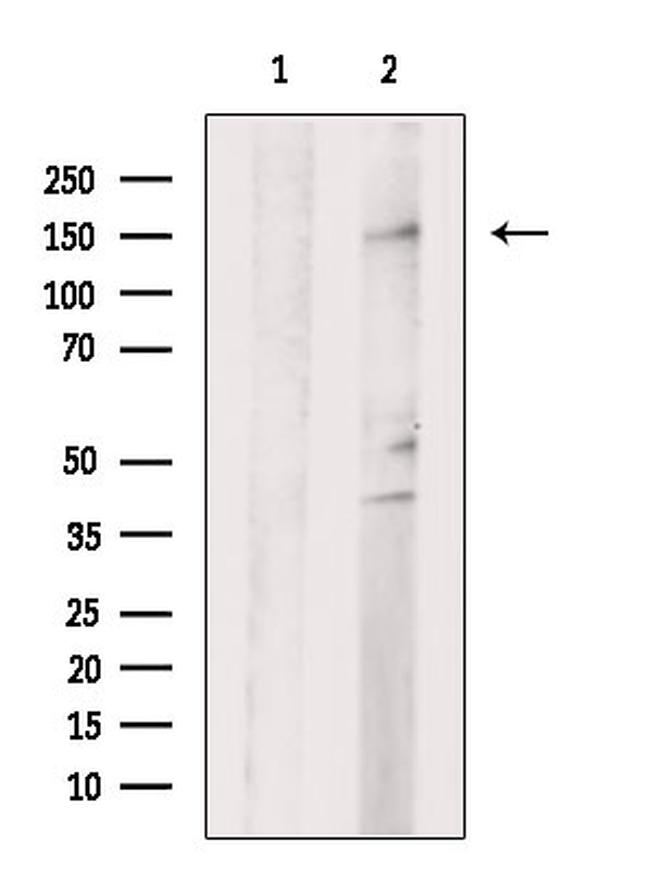 LATS2 Antibody in Western Blot (WB)