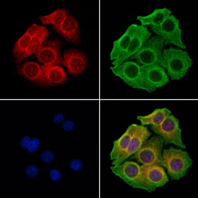 LDLR Antibody in Immunocytochemistry (ICC/IF)