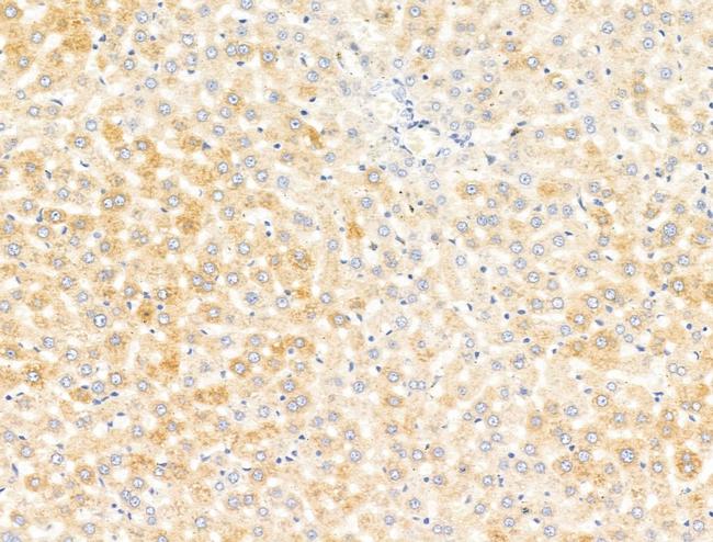 Lefty Antibody in Immunohistochemistry (Paraffin) (IHC (P))