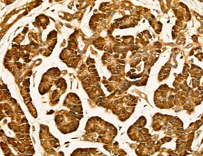 LIFR Antibody in Immunohistochemistry (Paraffin) (IHC (P))