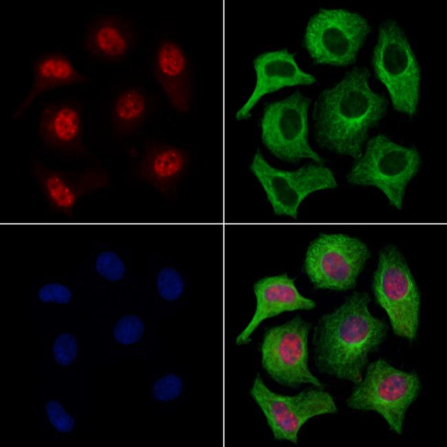 LMX1A Antibody in Immunocytochemistry (ICC/IF)