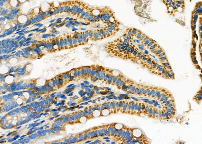 LRP1B Antibody in Immunohistochemistry (Paraffin) (IHC (P))