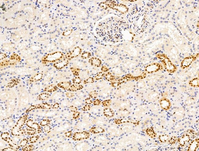 H2AFY2 Antibody in Immunohistochemistry (Paraffin) (IHC (P))