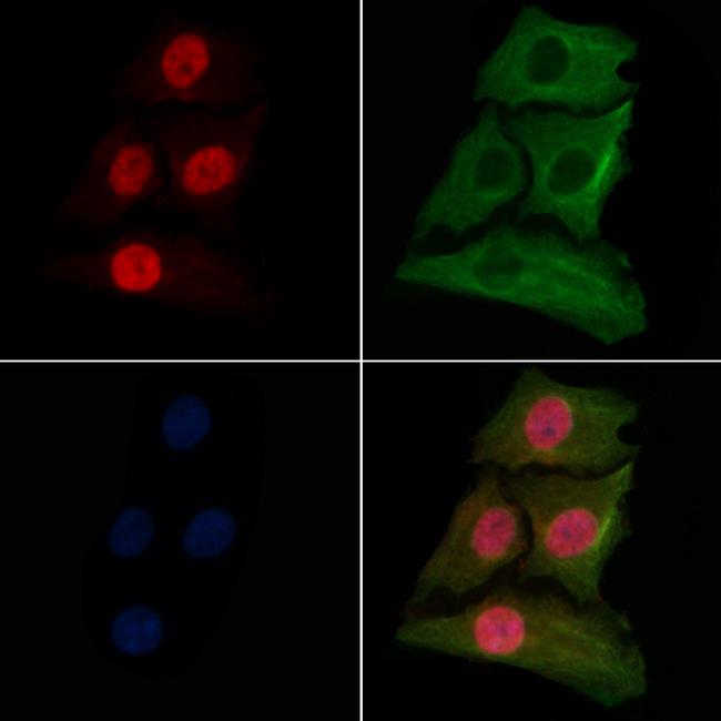 Histone Macro-H2A.1 Antibody in Immunocytochemistry (ICC/IF)