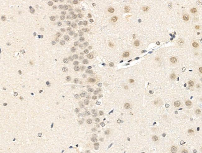 MAML2 Antibody in Immunohistochemistry (Paraffin) (IHC (P))