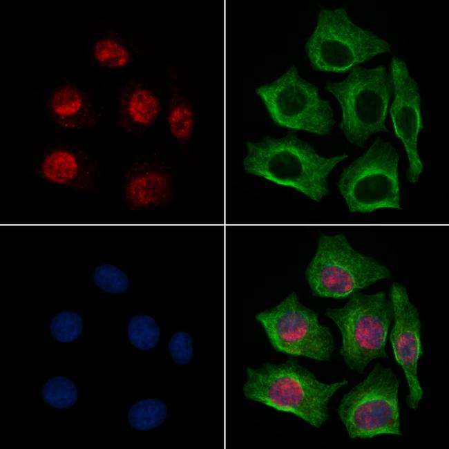 MAPKAPK3 Antibody in Immunocytochemistry (ICC/IF)