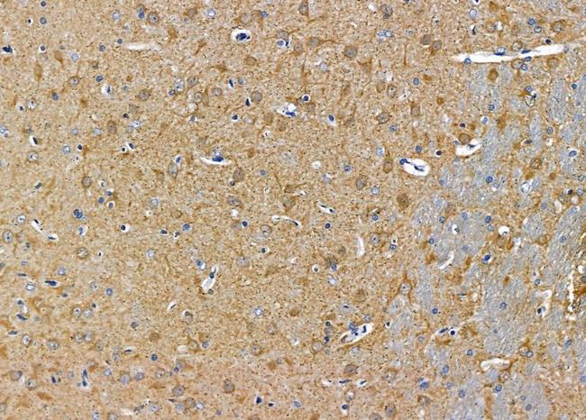 MARCH8 Antibody in Immunohistochemistry (Paraffin) (IHC (P))