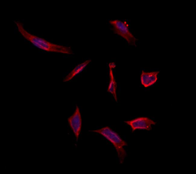 MAT1A Antibody in Immunocytochemistry (ICC/IF)