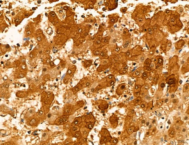 MAT2A Antibody in Immunohistochemistry (Paraffin) (IHC (P))