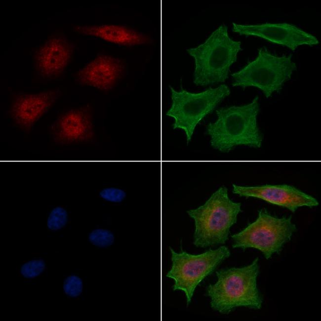 MCM7 Antibody in Immunocytochemistry (ICC/IF)