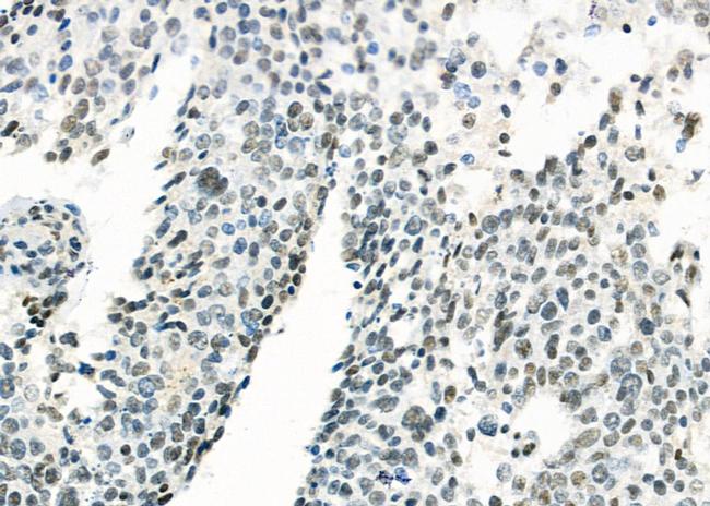 MED31 Antibody in Immunohistochemistry (Paraffin) (IHC (P))