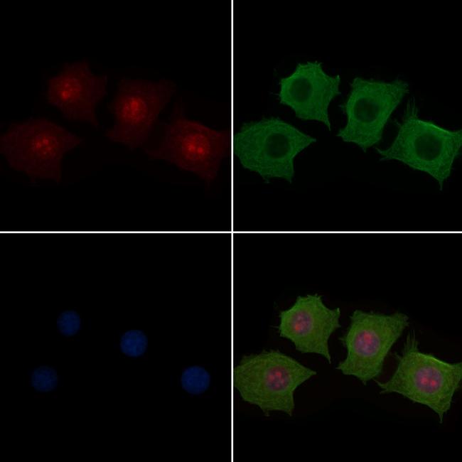 MAP2K1/MAP2K2 Antibody in Immunocytochemistry (ICC/IF)